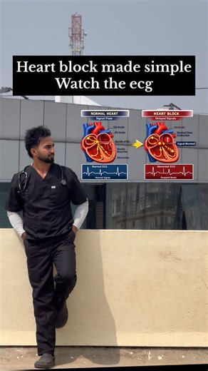 Fit.doc.ali🩺 on Instagram: "If electrical signals don’t pass properly from atria to ventricles, beats get delayed or dropped. Save this for exams, clinics, and quick ECG • #HeartBlock • #ECG • #MedEd • #Cardiology • mbbs • heart block explained • heart block ECG • AV block ECG • first second third degree heart block • ECG interpretation basics • cardiology for medical students • dropped beats ECG • PR interval heart block"