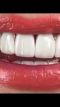 Beauty Close up Teeth & Lips 💋