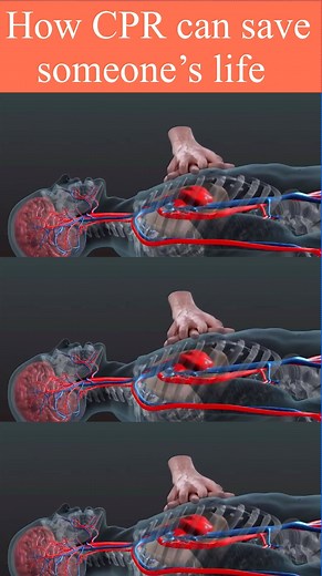 392K views · 4.5K reactions | How CPR can save someone’s life Animation | Health Sector #Shorts #reel #reels #nursing #fbreel #fbreels #trending #CPR | Surajit Tripura | Facebook