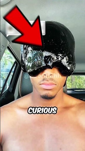 Venom Under Microscope 🕳️🔬