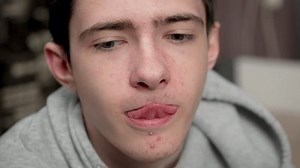 Teenage boy with acne prone skin runs tongue over dry lips. Adolescent male with blemished skin moistens chapped lips with tongue. Young guy with troubled skin slides tongue across cracked lips