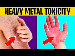 6 Skin Signs of HEAVY METAL TOXICITY You Shouldn't Ignore
