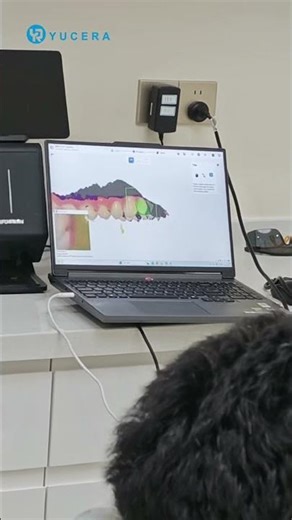 Customer Feedback: YRC-S03 Intraoral Scanner | Fast Full-Arch Scanning & Lightweight Precision