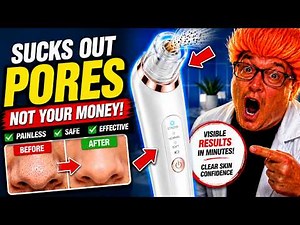 Watch Me Suck out my Blackheads!