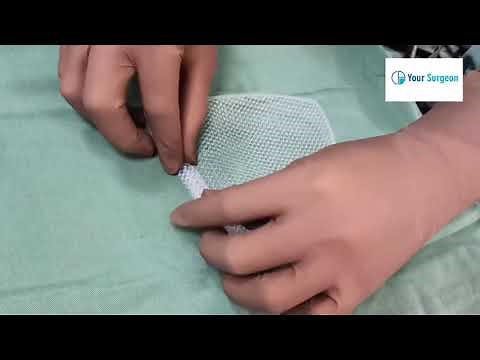 Best Mesh for Inguinal Hernia ?