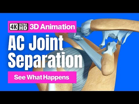 AC Joint Separation - 4K 3D Animation