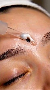 Extreme Macro Glabella ASMR | Deep Forehead Sebum & Blackhead Removal #asmr #skincare