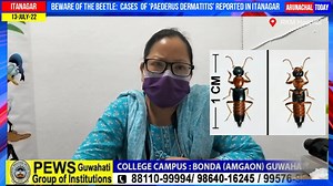 54K views · 801 reactions | Beware of the Beetle: Cases of ‘Paederus dermatitis’ reported in Itanagar | Arunachal Today | Facebook