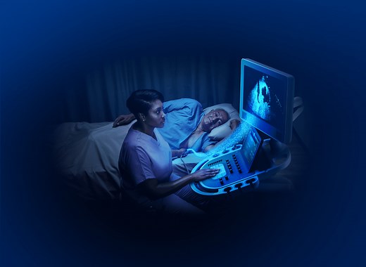 How to Use DEFINITY®