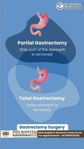 Gastrectomy surgery