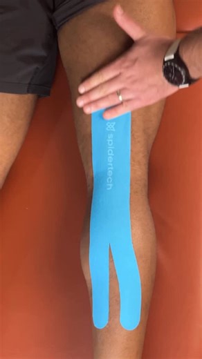 Spidertech Kinesiology Tape on Instagram: "Taping For Sore Hamstrings. Comment “Tape” Below To Unlock Our Masterclass. Hamstring discomfort is one of the most common lower-body complaints—especially after high-intensity training, prolonged sitting, or poor hip mechanics. Whether you're recovering from a strain, general overuse, or tension related to lumbar dysfunction, supporting the hamstring area can make a big difference.⁠ ⁠ Taping can assist with:⁠ • Mild hamstring strains (Grade I)⁠ • Delay