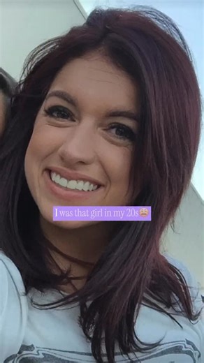 In my 20s, I started getting tox. I was receiving these treatments mostly as prevention. I always told myself I’d never do filler because I didn’t want to look fake. Fast forward a few years…I became an injector, learned quite a bit, and also used GLP 1’s to help with weight loss. After losing a significant amount of weight, I noticed something no one really talks about enough: the loss of facial volume. My face didn’t look “different” in a good way…it looked hollow, gaunt, and even older…it jus