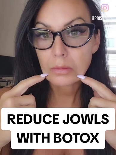 Botox Mapping for Jowls: Achieve Precision and Safety