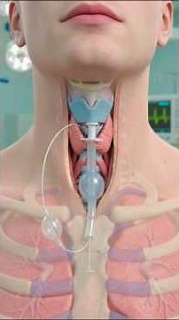 how is tracheostomy done?