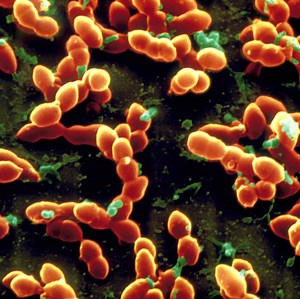 Streptococcus pneumoniae, causes, prevention, diagnosis, treatment & prognosis