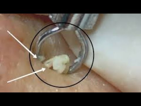 Relaxing Everyday With Loan Nguyen Skincare #5171