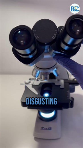 This is what’s under your nails 😱