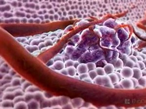 3D Medical Animation - What is Cancer?