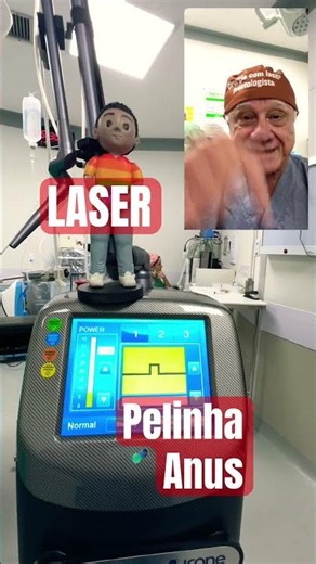 Anal skin tag: Carbon dioxide laser surgery w/ Dr. Paulo Branco.