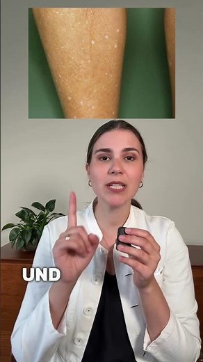 White spots: harmless, fungus, or vitiligo?