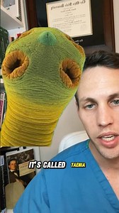 Brain worm explained #infectiousdiseases #brain #brainworm