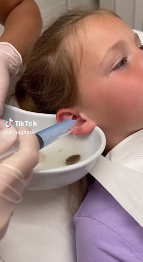 Effective Earwax Removal for Children