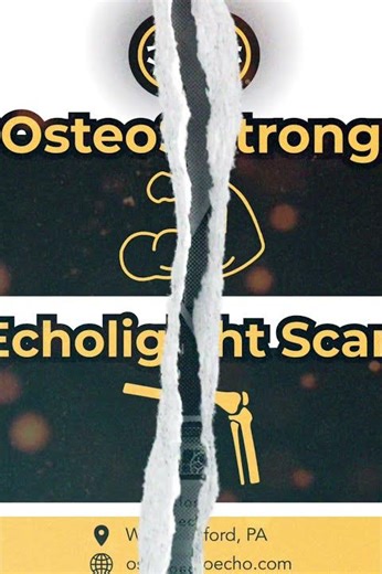 🦴 Discover the Power of Osteogenic Loading