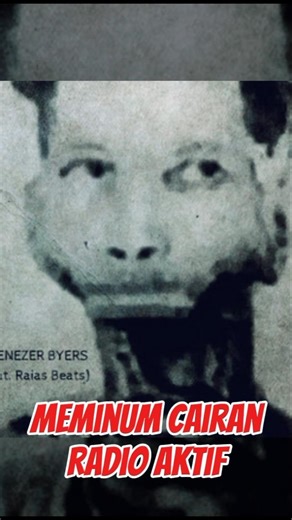 Manusia Yang Terkena⁉️😱😱 Radio Aktif (part 40) #respectshorts #ytshorts #shorts