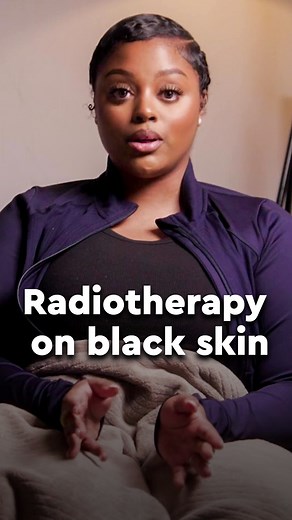 Nellie was diagnosed with breast cancer at age 26, just three months after giving birth. She faced a distinct lack of representation before beginning her radiotherapy treatment, and has also been affected by cancer-related misinformation throughout her journey. “Some of the misconceptions that impacted me include the belief that young people don’t get cancer, that you don’t need to worry if there’s no family history, and that cancer is always a death sentence.” Our latest data shows that over ha