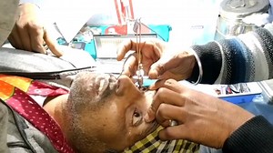 Schiotz眼压计的使用