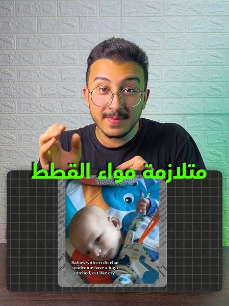 صوت مواء القطط وأسرار متلازمة بكائها