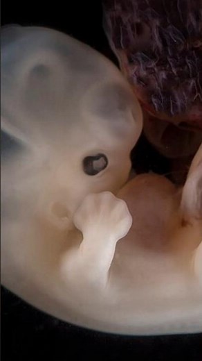 XX, XY... That's Not the Whole Story | sex chromosome | sex determination