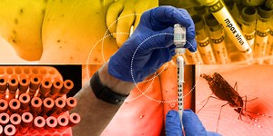 Sarampión, Mpox, Dengue y más: enfermedades que amenazan a México en 2025