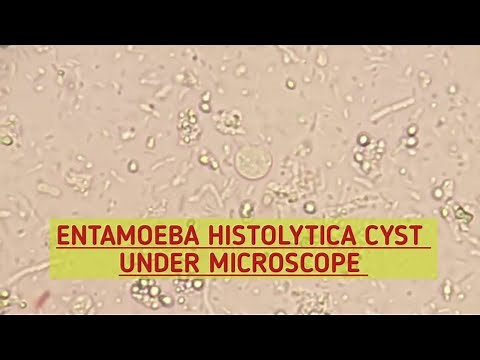 Entamoeba Histolytica (E.H)cyst under microscope.Stool Microscopy.Stool Parasites under microscope.