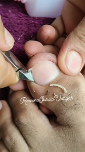 Toenailcleaning #nailsoftheday #pedicure | Rowena Garcia Vargas
