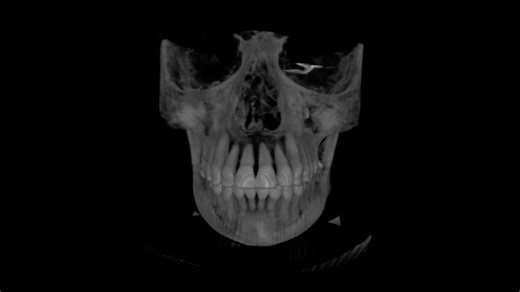 Real-Time Volume Rendering with OpenGL and GLSL | Saurabh D. posted on the topic | LinkedIn