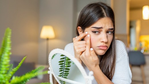 Oily skin giving you pimples? These 7 superfoods are what you need