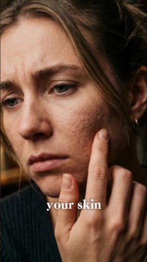 Why Your Skin Gets Rough 😳 (Simple Explanation)