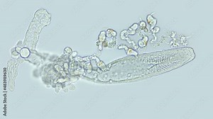 Part of Siphonophora colony under a microscope, class Hydrozoa. Trapping tentacles, gonozoid or gastrozoid are visible. Sample found in Red Sea