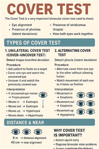 Cover Test #opthalmology #optometry #Strabismus