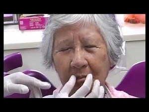 Tooth Try In Stage for complete denture