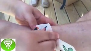 1.1M views · 2.2K reactions | pimple Warning !!!!!!!!! Put the tools to remove the Blackhead | Dr pimple popper | Facebook