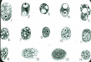 Infección por Dientamoeba fragilis - A-A-Z-Guías 2026