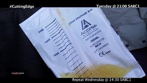 Cutting Edge exposes the pain behind botched circumcisions in the Eastern Cape and why the Penile Reconstruction Program meant to save young lives was suddenly shut down. Tuesday at 21:00 on SABC1. | Cutting Edge