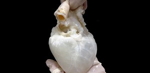 Lab-grown ‘ghost hearts’ work to solve organ transplant shortage by combining a cleaned-out pig heart with a patient’s own stem cells