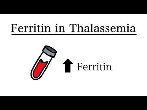 Iron Overload Mechanisms in Thalassemia: Transfusions and Low Hepcidin Explained