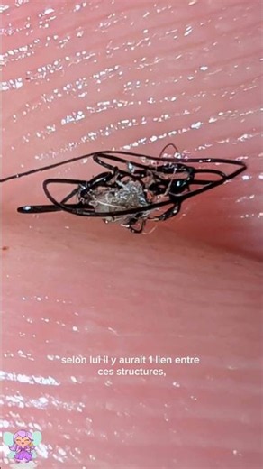 #morgellons #parasites #alerte