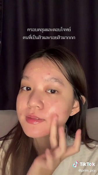 รีวิวเซรั่มยูเซอริน ลดรอยสิว สิวยุบ รอยสิวจาง