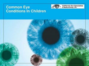 Common Eye Conditions In Children - SlideServe