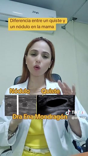 Quistes y Nódulos en las Mamas: Todo lo Que Debes Saber
